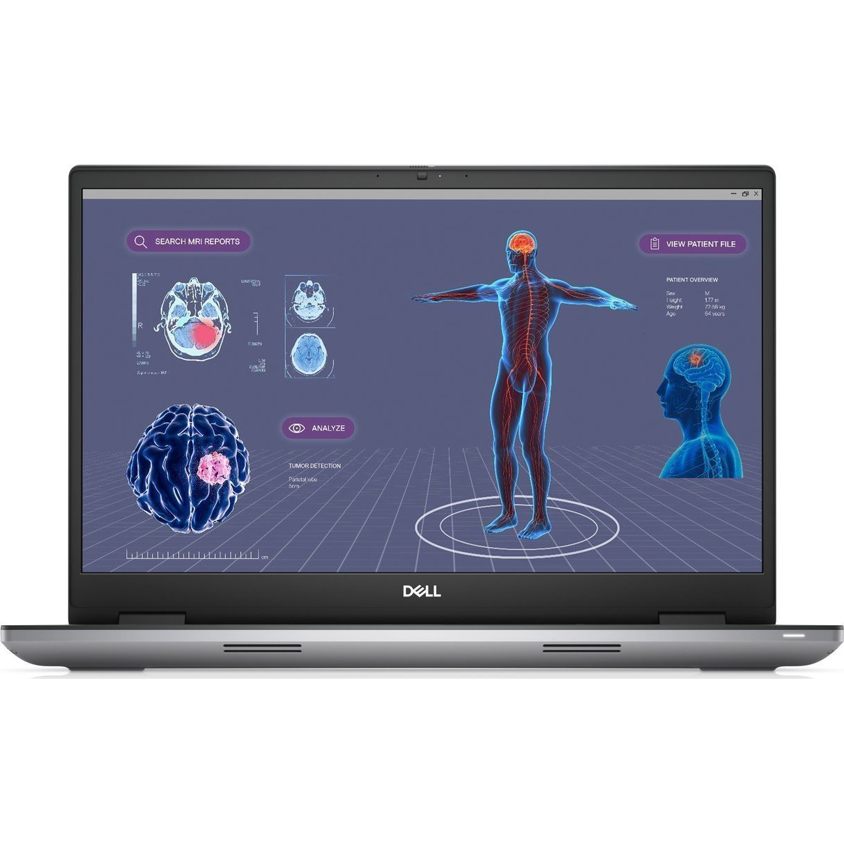 DELL Precision 7780 i7-13850HX Mobil munkaállomás 43,9 cm (17.3