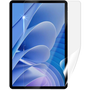 Screenshield DOOGEE T30 PRO LTE kijelzővédő fólia