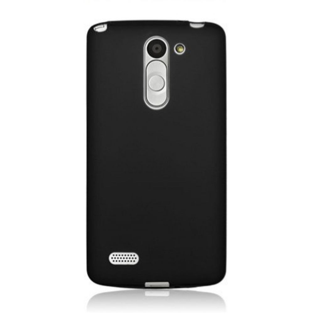 Cellect TPU-LG-M2-BK LG K10 szilikon hátlap 5