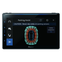 Pioneer SPH-EVO107DAB-UNI2 Érintőképernyős 9" WiFi Bluetooth Autó HiFi fejegység