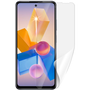 Screenshield INFINIX Hot 40i védőfólia