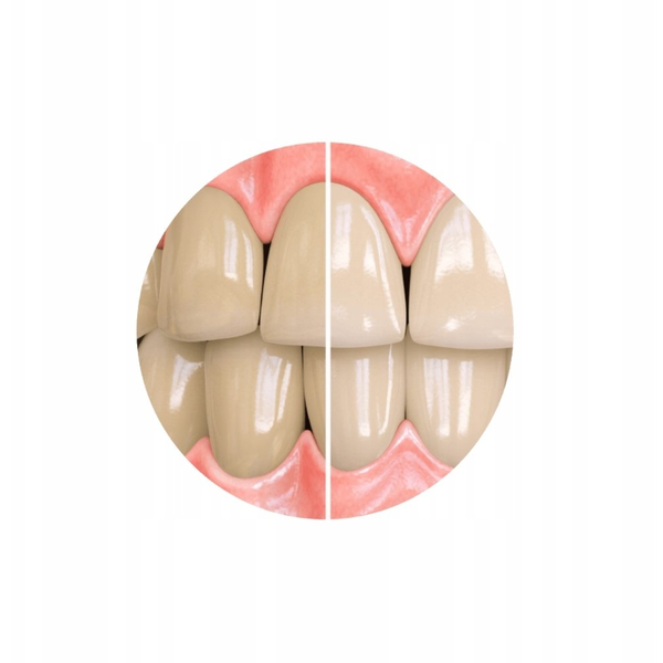 Sensitivity Relief Whitening Toothpaste (PdZ,UNI,100)