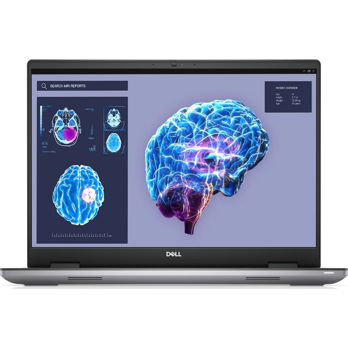 DELL Precision 7680 Intel® Core i7 i7-13850HX Mobil munkaállomás 40,6 cm (16